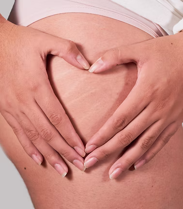 Scars and Stretch Marks